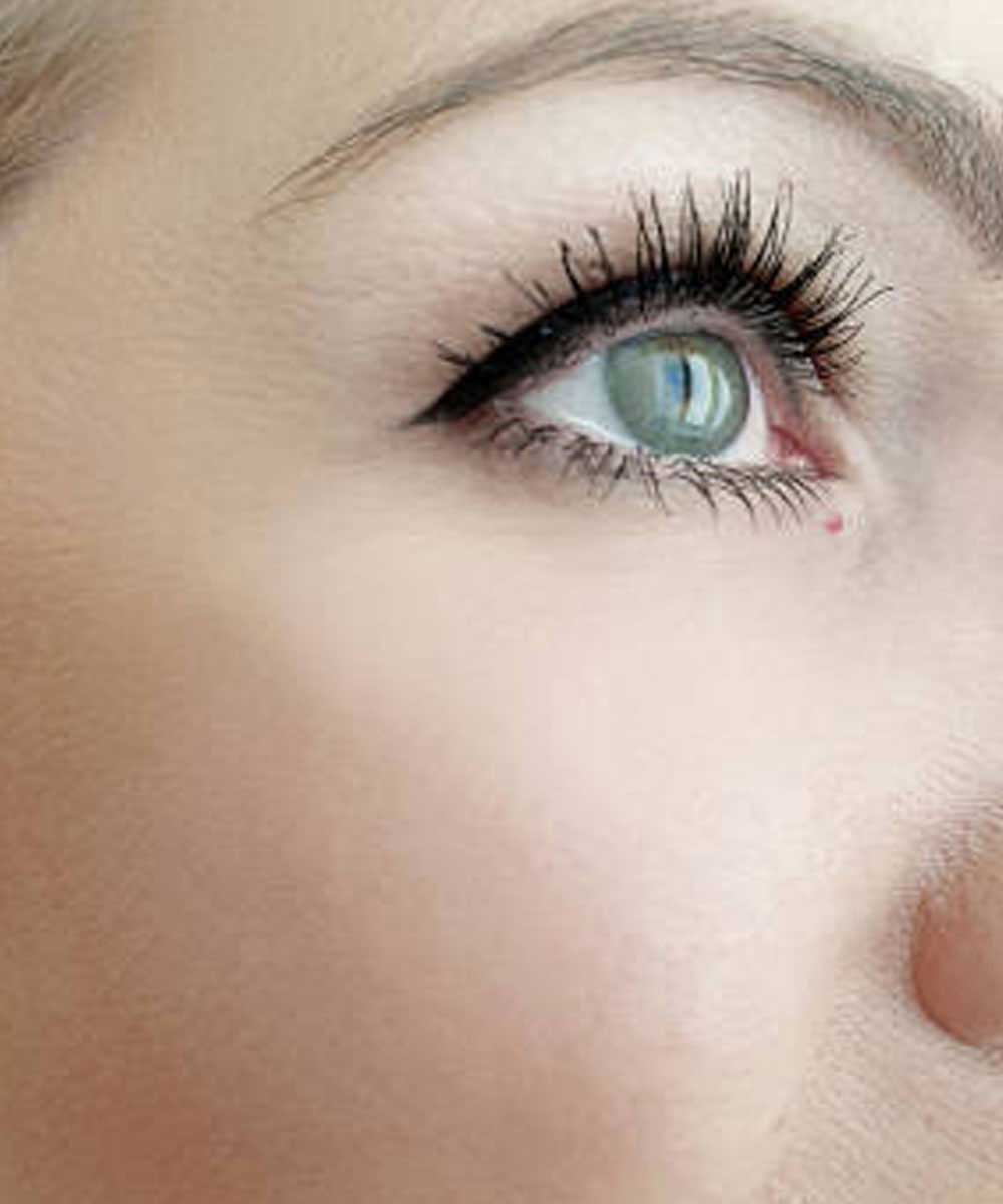 Botox eye treatment
